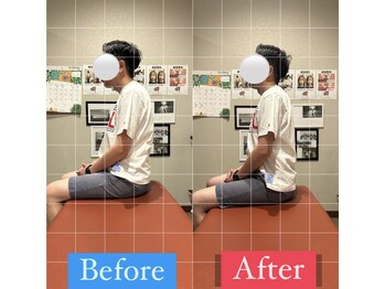 ナオル整体 宮崎院(NAORU整体)/30代男性施術事例【肩こり改善】