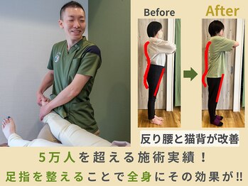 スロース鍼灸整体院(SLOTH鍼灸整体院)/総施術数 5万人を超える実績!