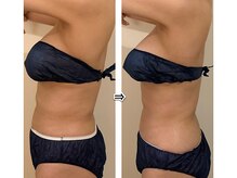 シーズ/お腹特化コース！ペタンコお腹へ