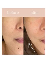 ハナワビューティーサロン(HanaWa beauty salon)/before&after