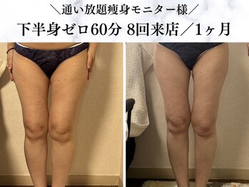 シーフェイス 横浜店(SEE FACE)/下半身ゼロダイエットモニター様