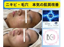 トータルサロンアイビーシー(トータルサロンIBC)の雰囲気（結果重視のフェイシャル◎プラズマで人生史上最高美肌へ！）
