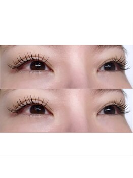 ブライズ(BRISE)/バインドロック