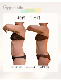 ジプソフィラ(Gypsophila)/痩身ビフォーアフター