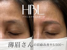 リモア(REMORE)/生えてこないと諦めないで！