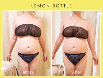 ハノハノ 八代店(HANO HANO)/【八代初導入!】レモンボトル☆