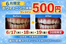 エランホワイトニング 一社店