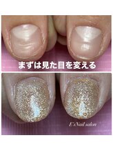 イーズ(E's)/深爪矯正長さ出しワンカラー
