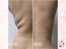 サロンドモアロ(Salon de Moaro)/Before/After