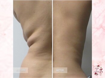 サロンドモアロ(Salon de Moaro)/Before/After