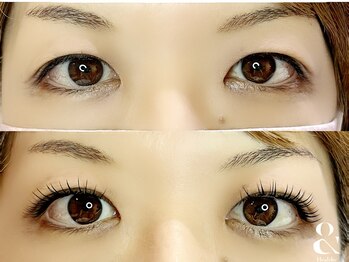 ドルーチェ(Doluce)/&Healthy/アンドヘルシー 120本