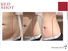 アンシャンテ(Anchant)/【レッドショット】