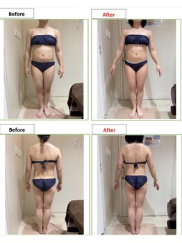 エステティック レイビス 銀座店(RAYVIS)/