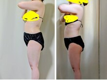 ひぺりかむ/【モニター】年末年始あけ横向き