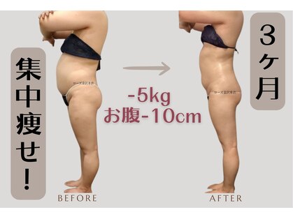 メディカルエステサロン ローズ 金沢本店(ROSE)の写真