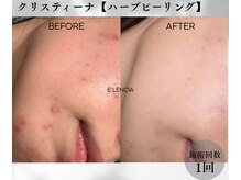 エレンシア(E'lencia)