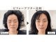 リラボ整体院 麻布十番店(RE+LAB=◯整体院)の写真/日本1受賞の独自の小顔矯正。小顔になりたい、歪みを改善させたい/麻布/麻布十番/赤阪/赤阪見附/整体/小顔