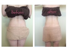 スリムアンドビューティー メゾン ド シュシュ(Slim&Beauty Maison de chouchou)/セル脂肪の分解！！