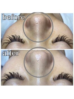 スパイア(SPIRE)/スーパーフードワックス★