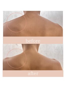 ハナワビューティーサロン(HanaWa beauty salon)/before&after