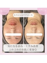 ミュー 豊田店(mieux)/◆ふわふわのお肌に早変わり