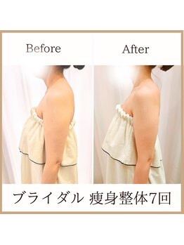 サロンルーチェ(Salon Luce)/ビフォーアフター/ブライダル