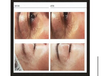 ビューティフルワールド0617(Beautiful World 0617)/カスマラ★目元集中ケア