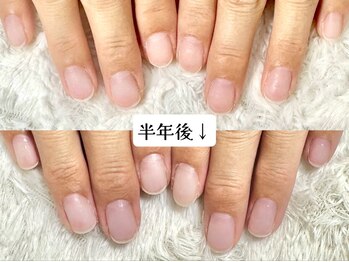 グラシナ なんば店/深爪/自爪育成/フィルイン
