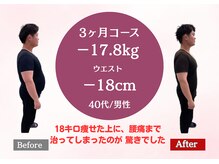 南桜井あおば鍼灸整骨院 春日部/ダイエット実績40代