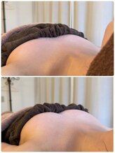 スマイルクルー(SmileClue)/初回60分のバスト変化