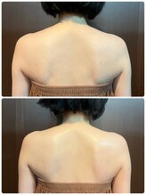 アミナス(Total Beauty Salon AMINAS)/華奢見えコルギ