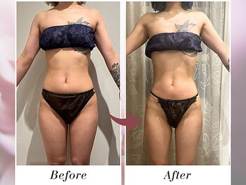 リボーン(boju reborn)/◆30代のお客様◆