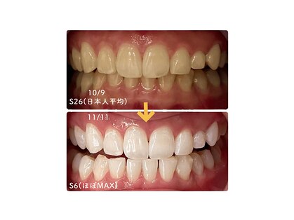 グロウ 東区香椎(GLOW)の写真