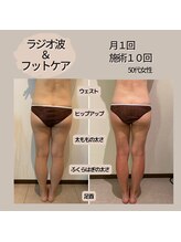 モーイエンチャーム(mooi en charme)/部位集中マッサージ×ラジオ波