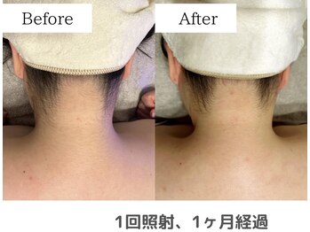 セオリー(Theory)/Before After