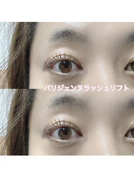 レディエント(Radiant)/パリジェンヌラッシュリフト