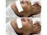 人気Ｎｏ.3【ハリ艶肌コース】小じわが気になるハリ・艶が欲しい方に◎