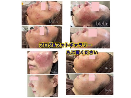 ビエル(Bielle)の写真