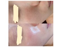 シエスタ 新小岩の雰囲気（天然のワックスと常在菌育成ケアで透明感溢れる美肌へ）