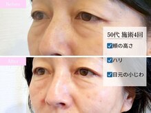サブリエ(Sablier)の雰囲気（細胞活性しながら自然なハリのある引き締まったお顔へ導きます♪）
