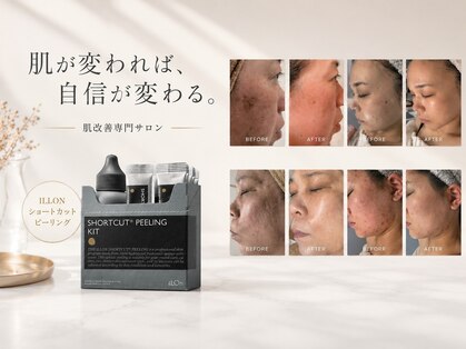 Ｓａｌｏｎ ｄｅ ＨＡＮＡ【眉毛/肌管理サロン】の写真
