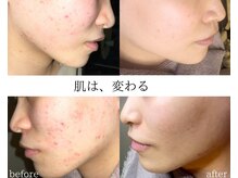 ル シーニュ 豊田市の雰囲気（プロセルセラピーズで諦めていた肌質も、理想へと近づけます。）