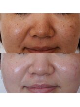 トラット エステアンドアイズ(tratto)/30代前半　お客様症例写真