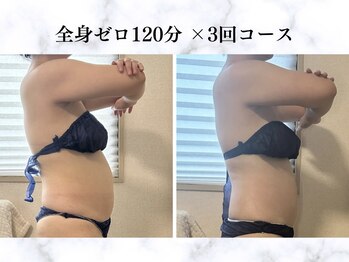 シーフェイス 横浜店(SEE FACE)/全身ゼロダイエットモニター様