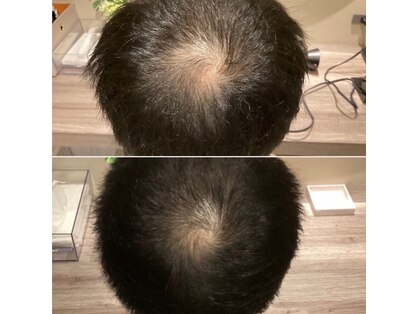 オレオール(aureole)の写真