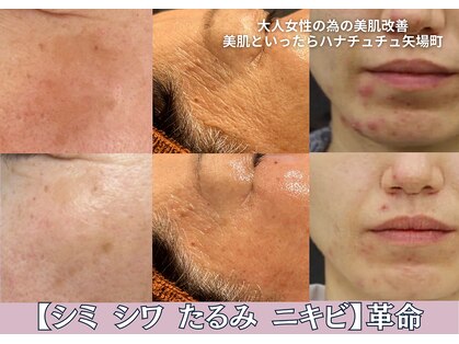 ハナ チュチュ(Hana chuchu)の写真