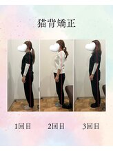 ゆるる(Yururu)/ビフォーアフター(猫背矯正)