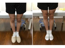 大砂土治療院/膝の症状に鍼灸マッサージ