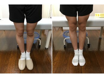 大砂土治療院/膝の症状に鍼灸マッサージ