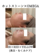 リラ 郡山店(Lilas)/美白・むくみケア